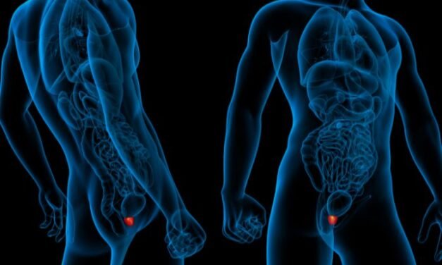 En Durango cáncer de próstata con mayor incidencia