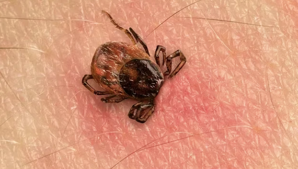 Muere niño en Torreón por Rickettsiosis; era de Gómez Palacio