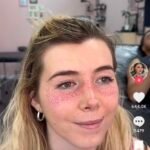 ‘Freckling’ tendencia que se ha vuelto viral que consiste en tatuarse pecas