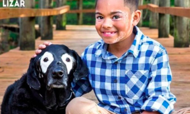 La inspiradora historia de Carter y cómo la amistad con un perro cambió su vida con vitiligo