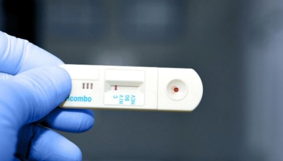 Científicos eliminan VIH de células infectadas: un avance crucial en la lucha contra el virus