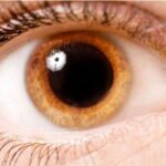 Búsquedas de «ardor de ojo» aumentan en Google después del eclipse