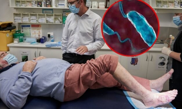 Aumento de casos de “Bacteria Carnívora” en Japón alertan al mundo