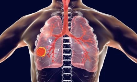 Avances en la lucha contra el cáncer de pulmón microcítico: un rayo de esperanza