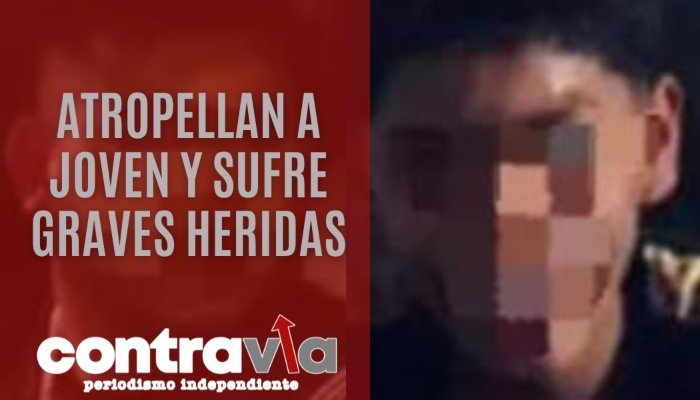 Atropellan a joven y sufre graves heridas, Torreón, Coahuila, 2024