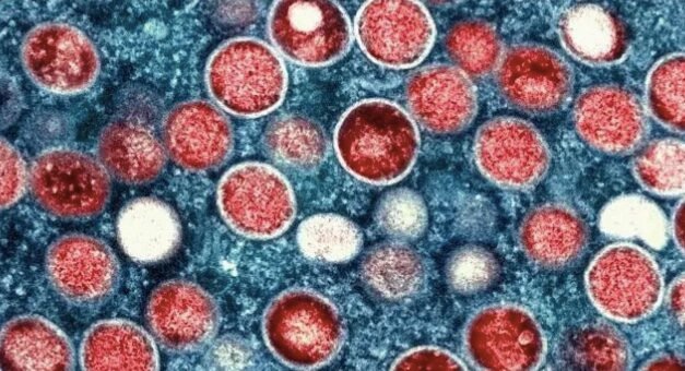 África enfrenta aumento alarmante de casos de Mpox en 2024