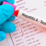 Coahuila es el segundo lugar nacional en casos de hepatitis A