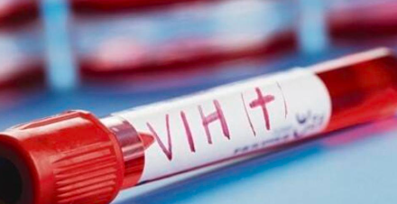 Preocupa baja en edad de detección de VIH en Laguna de Coahuila