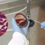 Brote de Klebsiella oxytoca deja 17 muertos en tres estados: avanza la investigación