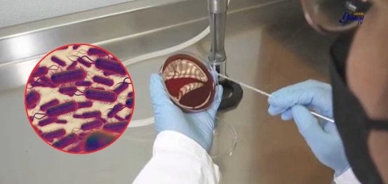 Brote de Klebsiella oxytoca deja 17 muertos en tres estados: avanza la investigación