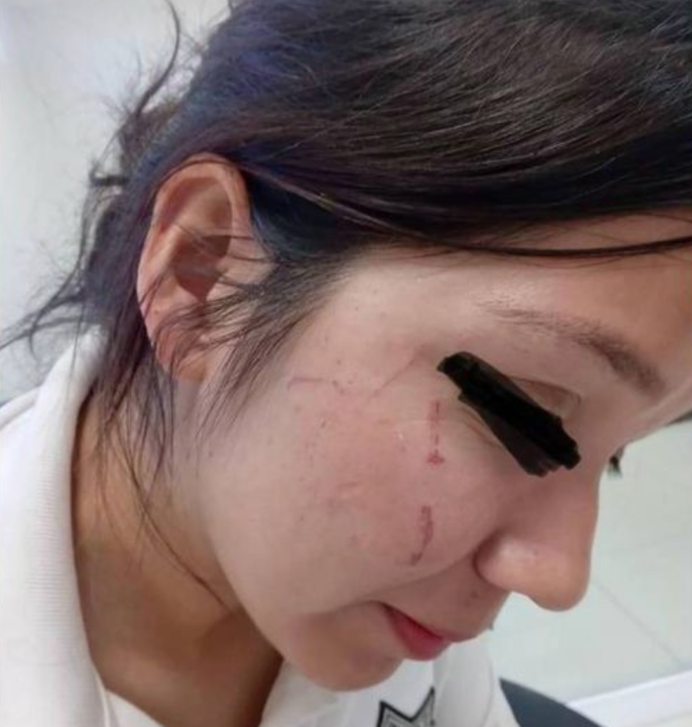 Tres detenidos por agredir a oficial de Tránsito en ejido Zaragoza; la amenazaron de muerte