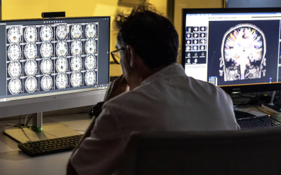 Alzhéimer: una nueva era con fármacos que frenan su avance y diagnósticos más tempranos