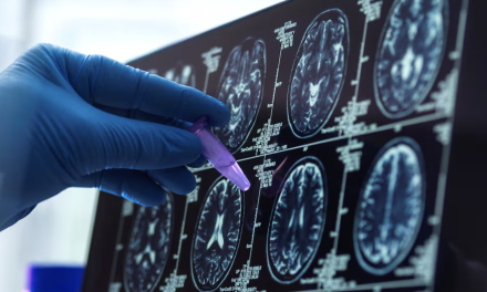 Una gota de sangre podría revolucionar el diagnóstico temprano del alzhéimer