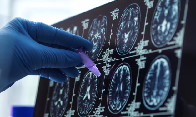 Una gota de sangre podría revolucionar el diagnóstico temprano del alzhéimer